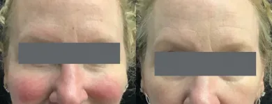 Business 4 image METRO MEDSPA Skin Care Clinic in St. Louis MO