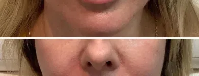 Business 5 image METRO MEDSPA Skin Care Clinic in St. Louis MO