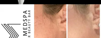 Business 12 image METRO MEDSPA Skin Care Clinic in St. Louis MO