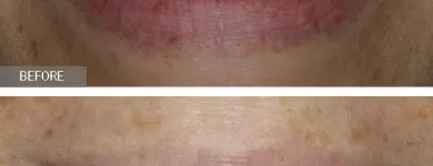 Business 5 image NYC DENTAL IMPLANTS CENTER Cosmetic Dentist in New York NY