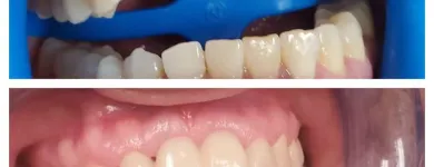 Business 1 image OPAL DENTAL Root Canal in Mesquite TX