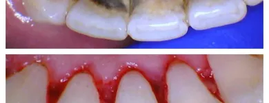 Business 2 image OPAL DENTAL Root Canal in Mesquite TX