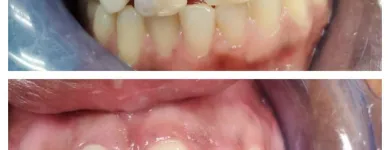 Business 3 image OPAL DENTAL Root Canal in Mesquite TX