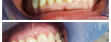 Business 4 image OPAL DENTAL Root Canal in Mesquite TX