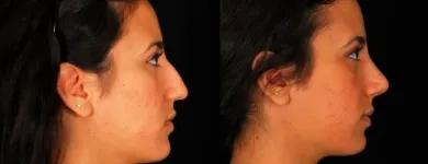 Business 1 image PETER B FODOR MD, FACS Tummy Tuck in Los Angeles CA