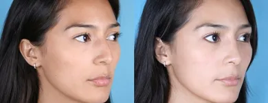 Business 1 image RAWNSLEY PLASTIC SURGERY Plastic Surgery Clinic in Los Angeles CA