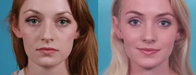 Business 3 image RAWNSLEY PLASTIC SURGERY Plastic Surgery Clinic in Los Angeles CA