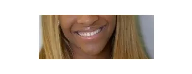 Business 2 image SMILE CENTER OF HUNTSVILLE Dentists in Huntsville AL