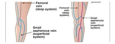 Business 6 image ST LOUIS LASER VEIN CENTER in St. Louis MO