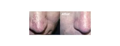 Business 13 image ST LOUIS LASER VEIN CENTER in St. Louis MO
