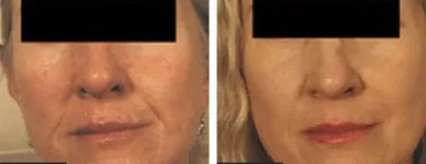 Business 21 image ST LOUIS LASER VEIN CENTER in St. Louis MO