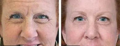 Business 25 image ST LOUIS LASER VEIN CENTER in St. Louis MO
