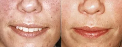 Business 26 image ST LOUIS LASER VEIN CENTER in St. Louis MO