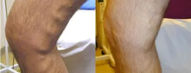 Business 28 image ST LOUIS LASER VEIN CENTER in St. Louis MO