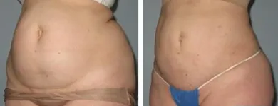 Business 36 image ST LOUIS LASER VEIN CENTER in St. Louis MO