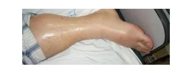 Business 51 image ST LOUIS LASER VEIN CENTER in St. Louis MO