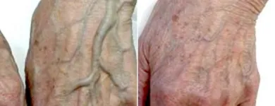 Business 61 image ST LOUIS LASER VEIN CENTER in St. Louis MO