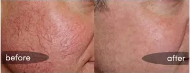 Business 65 image ST LOUIS LASER VEIN CENTER in St. Louis MO