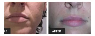 Business 69 image ST LOUIS LASER VEIN CENTER in St. Louis MO