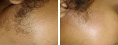 Business 73 image ST LOUIS LASER VEIN CENTER in St. Louis MO