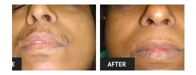 Business 74 image ST LOUIS LASER VEIN CENTER in St. Louis MO