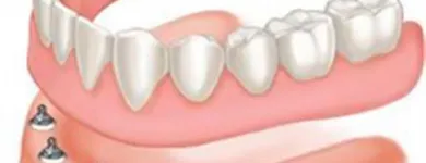 Business 4 image TOOTH IMPLANTS Dentists in Delmar NY