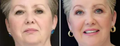 Business 6 image TULSA PLASTIC SURGERY Physicians & Surgeons, Surgery-General in Tulsa OK