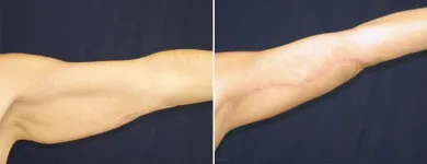 Business 3 image TULSA PLASTIC SURGERY Physicians & Surgeons, Surgery-General in Tulsa OK