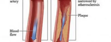 Business 1 image USA VASCULAR CENTERS in Fort Worth TX