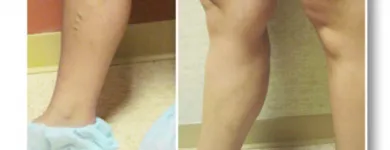 Business 2 image USA VEIN CLINICS Vein Doctor in Brooklyn NY