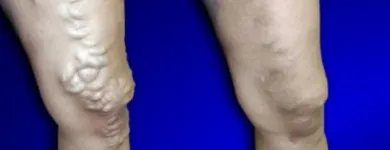 Business 1 image USA VEIN CLINICS Vein Doctor in New York NY