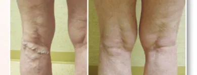 Business 3 image USA VEIN CLINICS Vein Doctor in Brooklyn NY