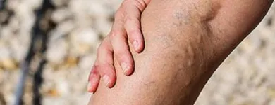 Business 2 image VARICOSE VEIN TREATMENTS CENTER Doctors in New York NY