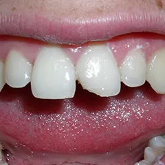 Business 6 image EMERGENCY DENTAL SERVICE ORANGE, CA 92867