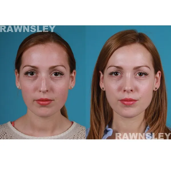 Business 2 image RAWNSLEY PLASTIC SURGERY
