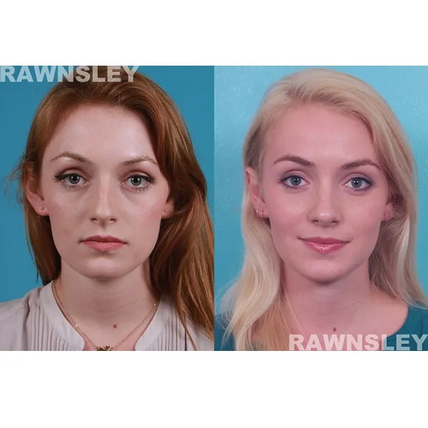 Business 3 image RAWNSLEY PLASTIC SURGERY