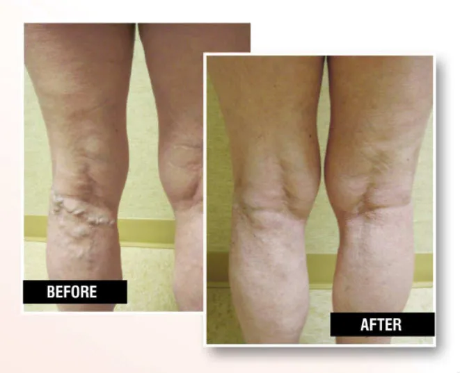 Business 2 image USA VEIN CLINICS