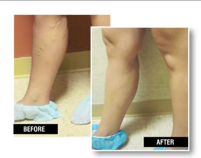 Business 3 image USA VEIN CLINICS