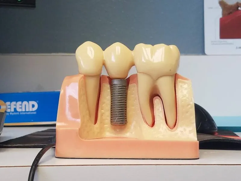 Business 7 image AA SOUTH FLORIDA DENTISTRY